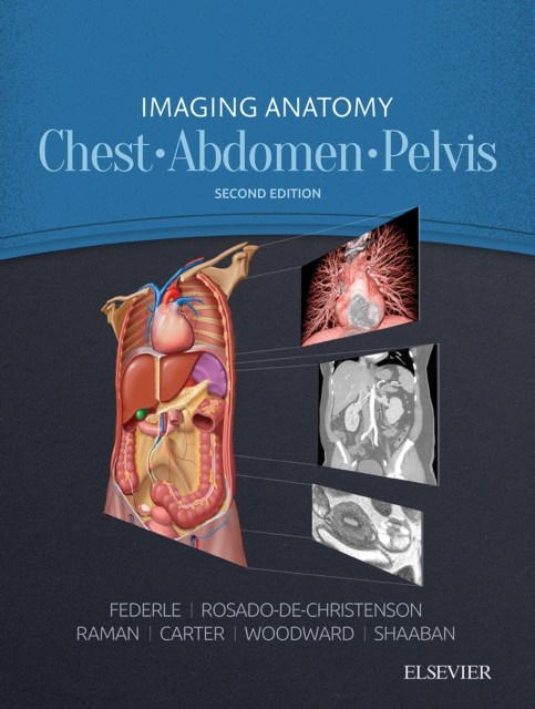 Imaging Anatomy: Chest, Abdomen, Pelvis : Imaging Anatomy: Chest, Abdomen, Pelvis E-Book, EPUB eBook