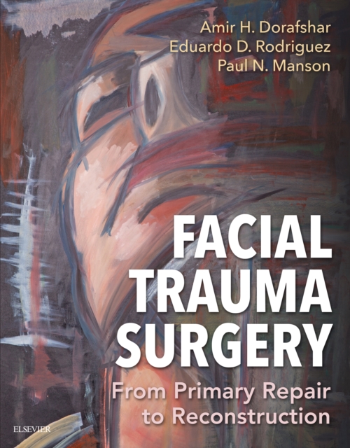 Facial Trauma Surgery : From Primary Repair to Reconstruction, EPUB eBook