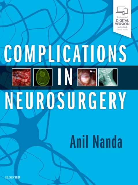 Complications in Neurosurgery, Hardback Book