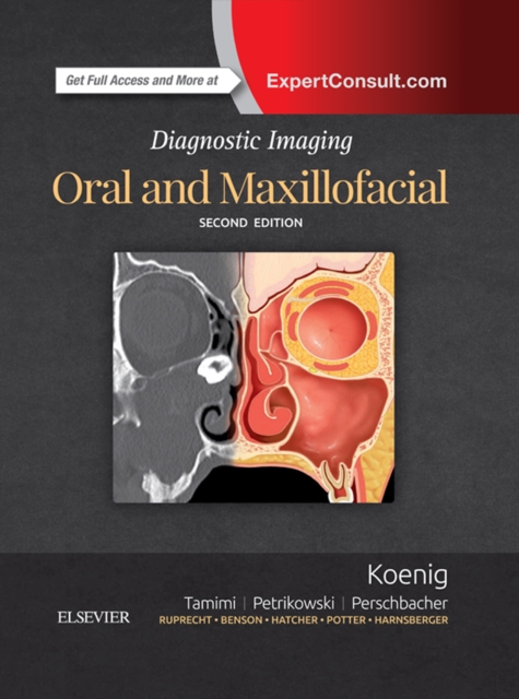 Diagnostic Imaging: Oral and Maxillofacial E-Book : Diagnostic Imaging: Oral and Maxillofacial E-Book, EPUB eBook
