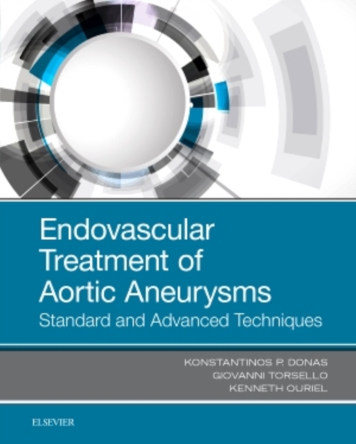 Endovascular Treatment of Aortic Aneurysms : Standard and Advanced Techniques, Hardback Book