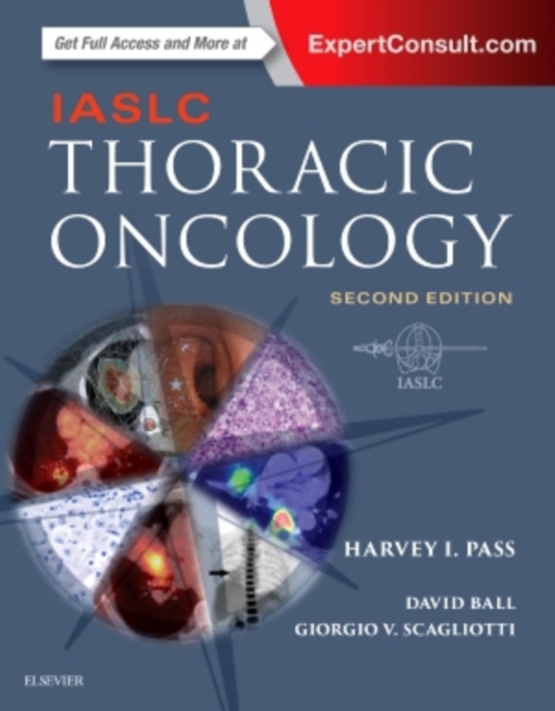 IASLC Thoracic Oncology, Hardback Book