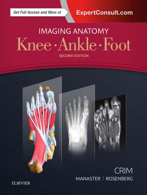 Imaging Anatomy: Knee, Ankle, Foot E-Book : Imaging Anatomy: Knee, Ankle, Foot E-Book, PDF eBook