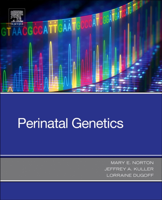 Perinatal Genetics, Paperback / softback Book