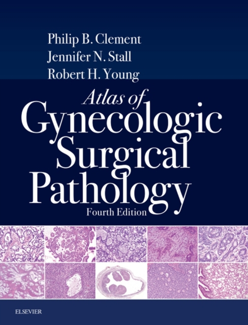 Atlas of Gynecologic Surgical Pathology E-Book : Atlas of Gynecologic Surgical Pathology E-Book, EPUB eBook