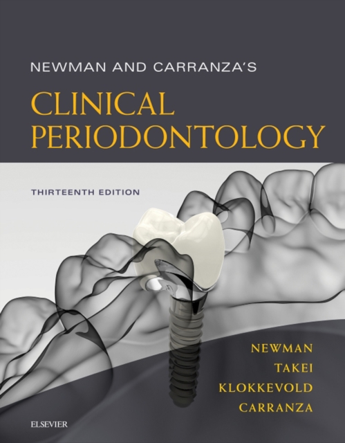 Newman and Carranza's Clinical Periodontology E-Book : Newman and Carranza's Clinical Periodontology E-Book, EPUB eBook