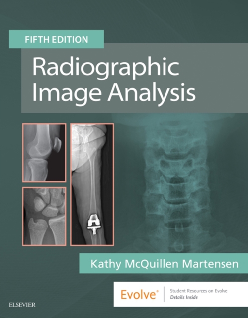 Radiographic Image Analysis E-Book : Radiographic Image Analysis E-Book, EPUB eBook