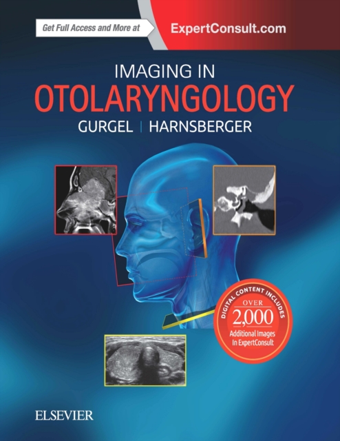 Imaging in Otolaryngology, Hardback Book