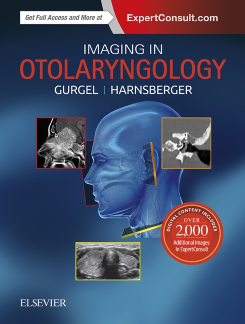 Imaging in Otolaryngology E-Book : Imaging in Otolaryngology E-Book, EPUB eBook