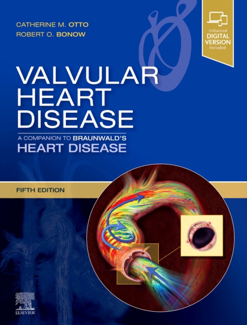 Valvular Heart Disease: A Companion to Braunwald's Heart Disease, Hardback Book