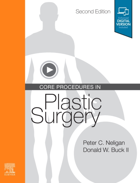 Core Procedures in Plastic Surgery, Hardback Book