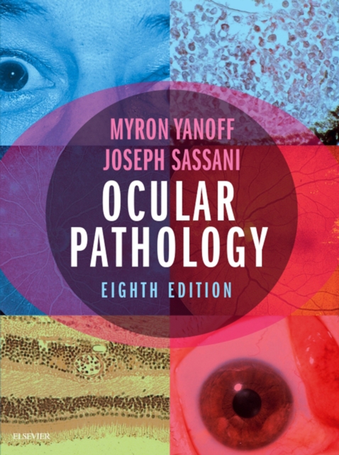 Ocular Pathology, EPUB eBook