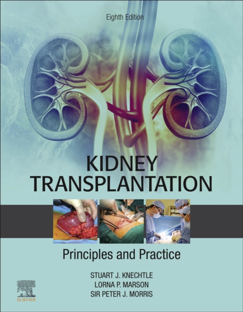 Kidney Transplantation - Principles and Practice E-Book, EPUB eBook