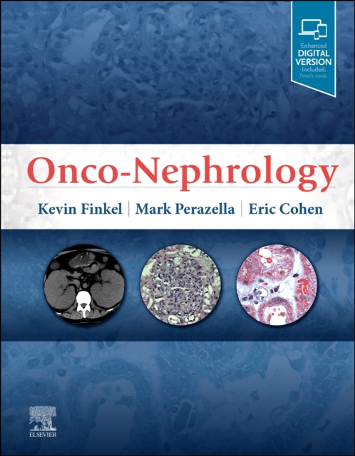 Onco-Nephrology, Hardback Book
