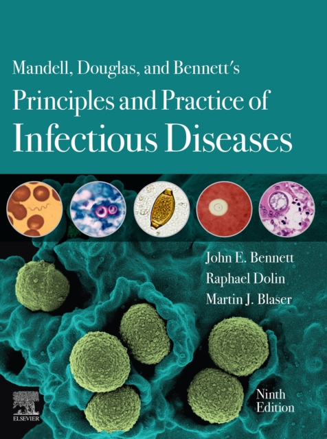 Mandell, Douglas, and Bennett's Principles and Practice of Infectious Diseases E-Book : 2-Volume Set, EPUB eBook