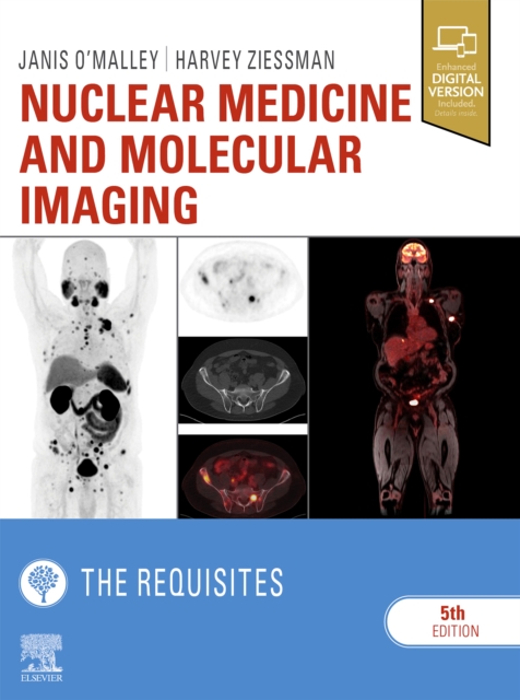 Nuclear Medicine and Molecular Imaging: The Requisites E-Book : Nuclear Medicine and Molecular Imaging: The Requisites E-Book, EPUB eBook
