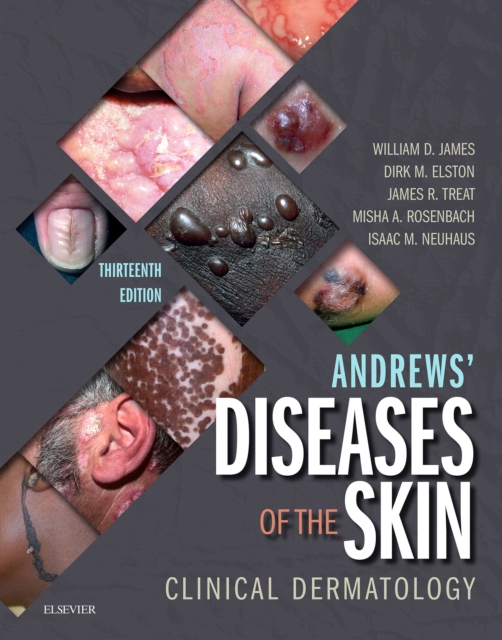 Andrews' Diseases of the Skin : Clinical Dermatology, EPUB eBook