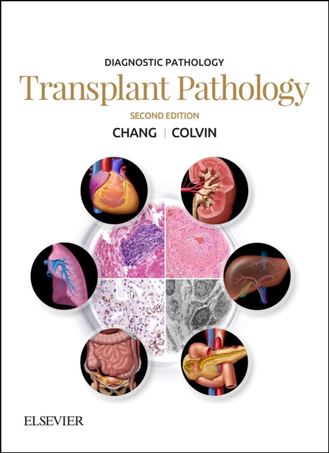 Diagnostic Pathology: Transplant Pathology E-Book : Diagnostic Pathology: Transplant Pathology E-Book, EPUB eBook
