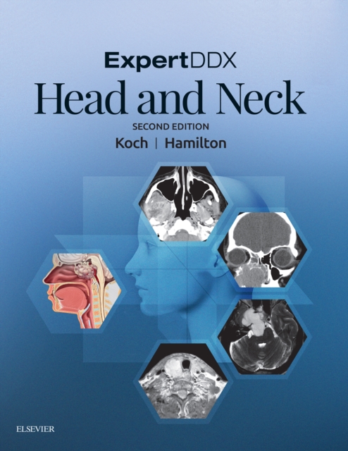 ExpertDDX: Head and Neck : ExpertDDX: Head and Neck - E-Book, EPUB eBook