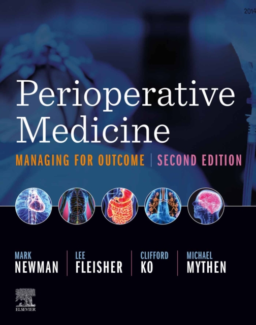 Perioperative Medicine E-Book : Managing for Outcome, EPUB eBook