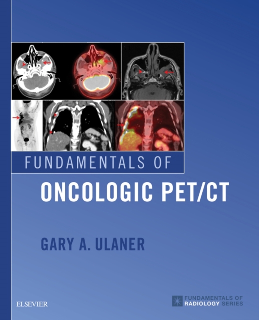 Fundamentals of Oncologic PET/CT E-Book, EPUB eBook