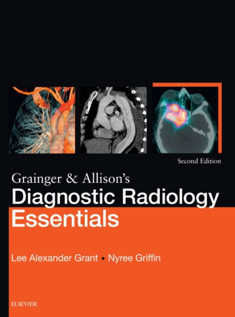 Grainger & Allison's Diagnostic Radiology Essentials E-Book : Grainger & Allison's Diagnostic Radiology Essentials E-Book, EPUB eBook
