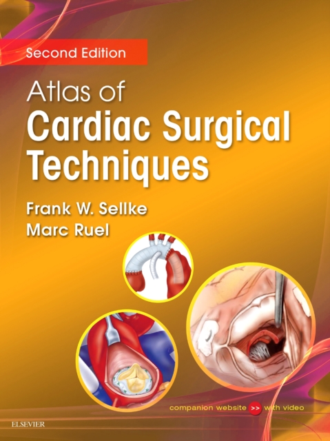 Atlas of Cardiac Surgical Techniques E-Book, EPUB eBook