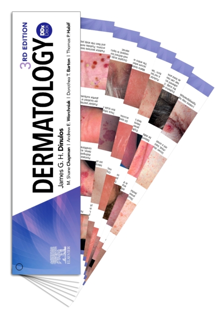 Dermatology DDX Deck, Paperback / softback Book