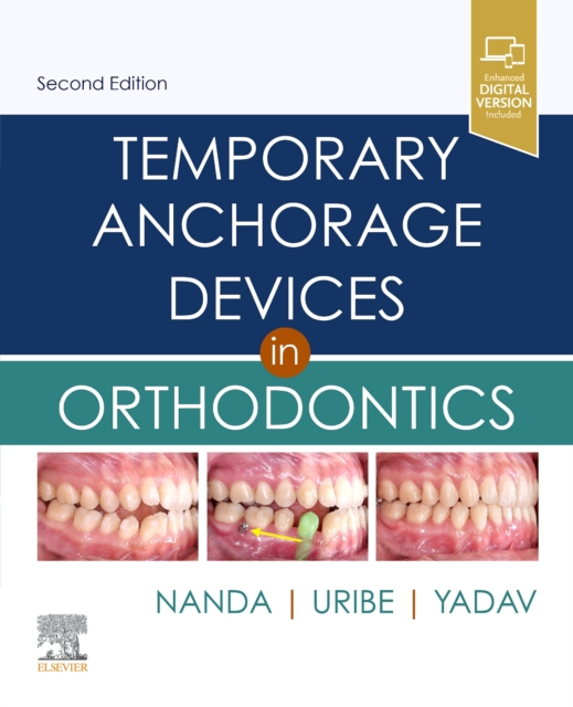 Temporary Anchorage Devices in Orthodontics, Hardback Book