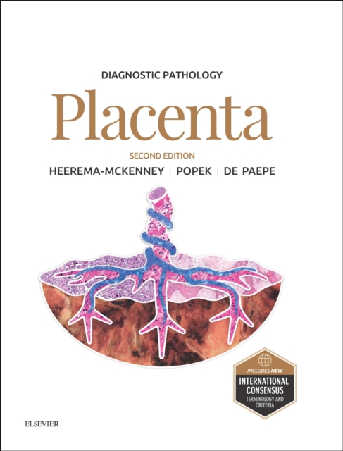 Diagnostic Pathology: Placenta : Diagnostic Pathology: Placenta E-Book, EPUB eBook