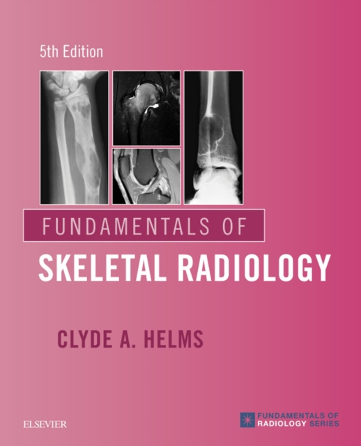 Fundamentals of Skeletal Radiology, EPUB eBook
