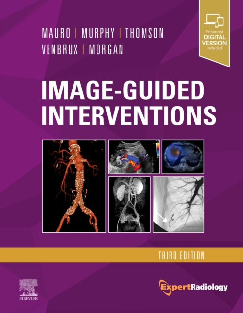 Image-Guided Interventions : Expert Radiology Series, Hardback Book