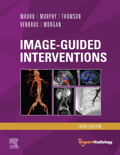 Image-Guided Interventions E-Book : Expert Radiology Series, EPUB eBook