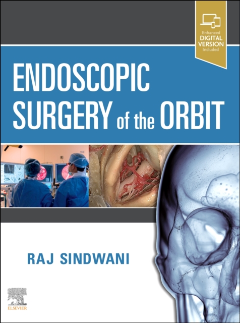 Endoscopic Surgery of the Orbit, Hardback Book