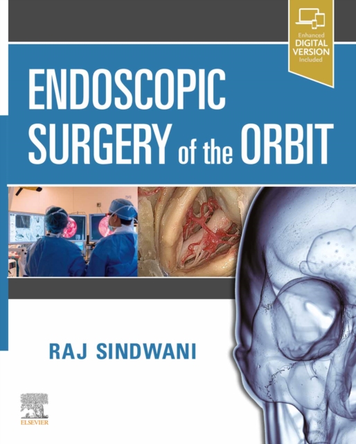 Endoscopic Surgery of the Orbit E-Book, EPUB eBook