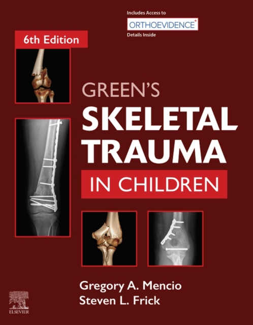 Green's Skeletal Trauma in Children E-Book, EPUB eBook