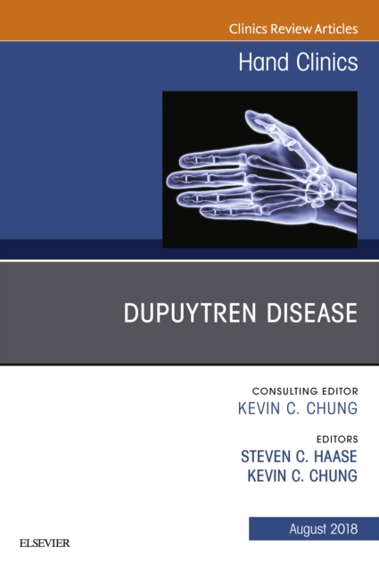 Dupuytren Disease, An Issue of Hand Clinics, EPUB eBook