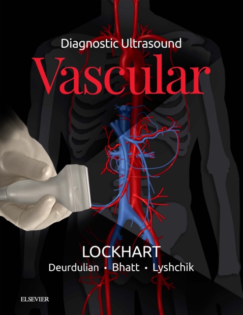 Diagnostic Ultrasound: Vascular, EPUB eBook