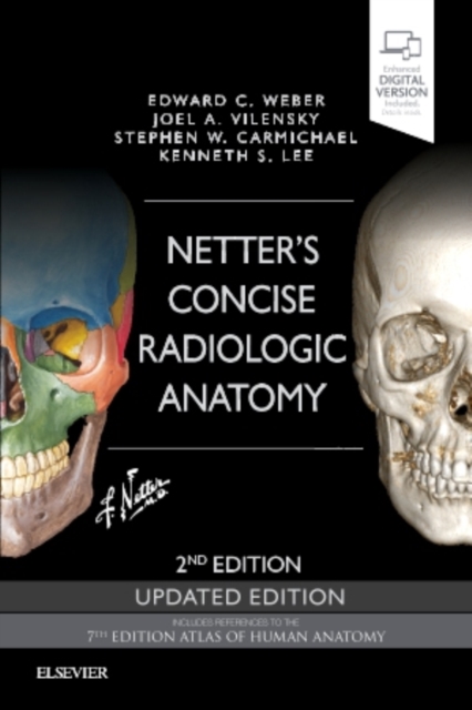 Netter's Concise Radiologic Anatomy Updated Edition, Paperback / softback Book