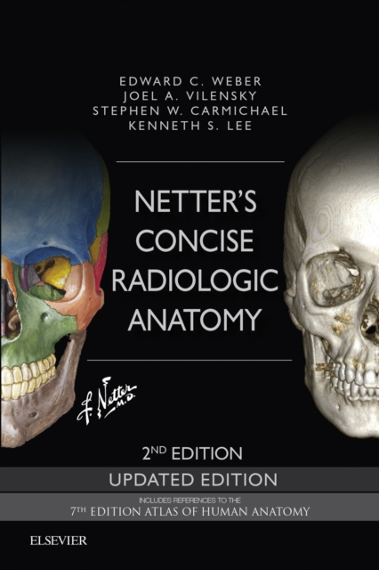 Netter's Concise Radiologic Anatomy Updated Edition E-Book : Netter's Concise Radiologic Anatomy Updated Edition E-Book, EPUB eBook