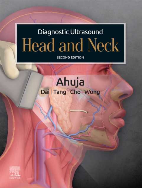 Diagnostic Ultrasound: Head and Neck E-Book : Diagnostic Ultrasound: Head and Neck E-Book, EPUB eBook