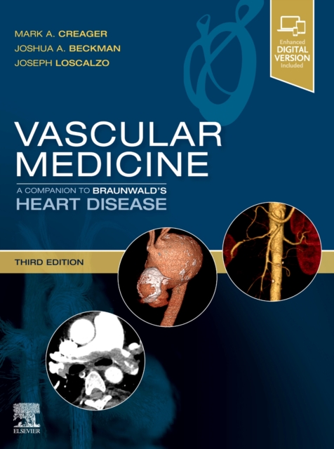 Vascular Medicine: A Companion to Braunwald's Heart Disease, Hardback Book