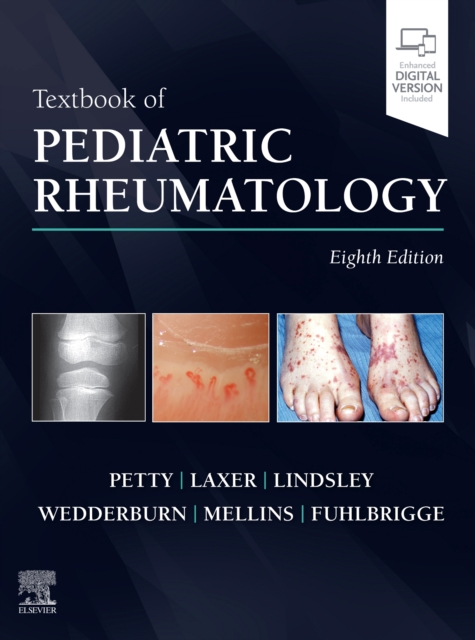 Textbook of Pediatric Rheumatology, Hardback Book
