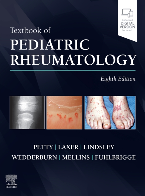 Textbook of Pediatric Rheumatology E-Book, PDF eBook
