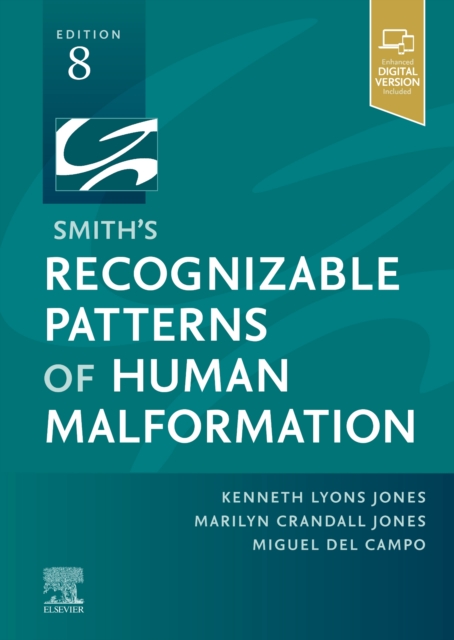 Smith's Recognizable Patterns of Human Malformation, Hardback Book
