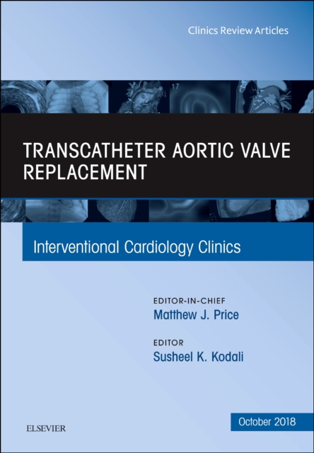 Transcatheter Aortic Valve Replacement, An Issue of Interventional Cardiology Clinics : Volume 7-4, Hardback Book