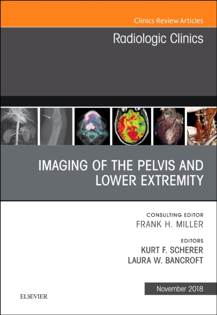 Imaging of the Pelvis and Lower Extremity, An Issue of Radiologic Clinics of North America : Volume 56-6, Hardback Book