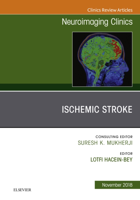Ischemic Stroke, An Issue of Neuroimaging Clinics of North America, EPUB eBook