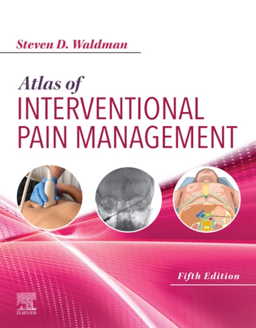 Atlas of Interventional Pain Management : Atlas of Interventional Pain Management E-Book, EPUB eBook
