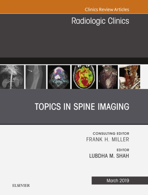 Topics in Spine Imaging, An Issue of Radiologic Clinics of North America, EPUB eBook